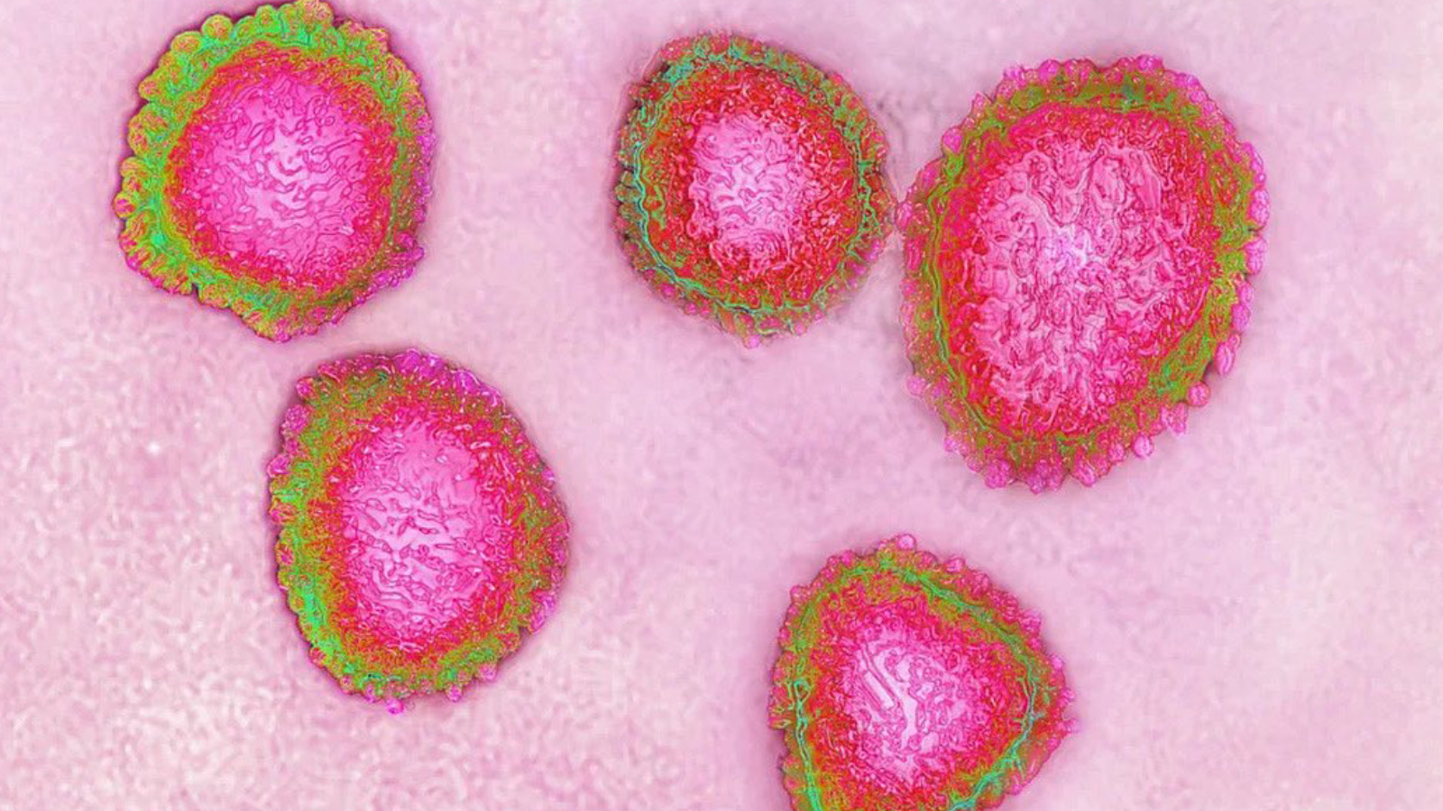 prof dr ceyhan uyariyor covid azalma noktasinda degil her yil artiyor turkiyede asisi yok Su6BWSig