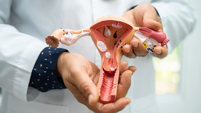 uzmani anlatti her on kadindan birinde polikistik over sendromu gorulebilir Yh5rObra